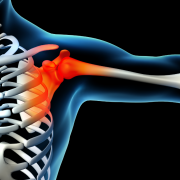 Shoulder Pain Charlotte