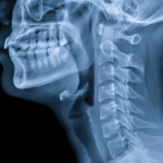 cervical spine