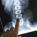 back pain